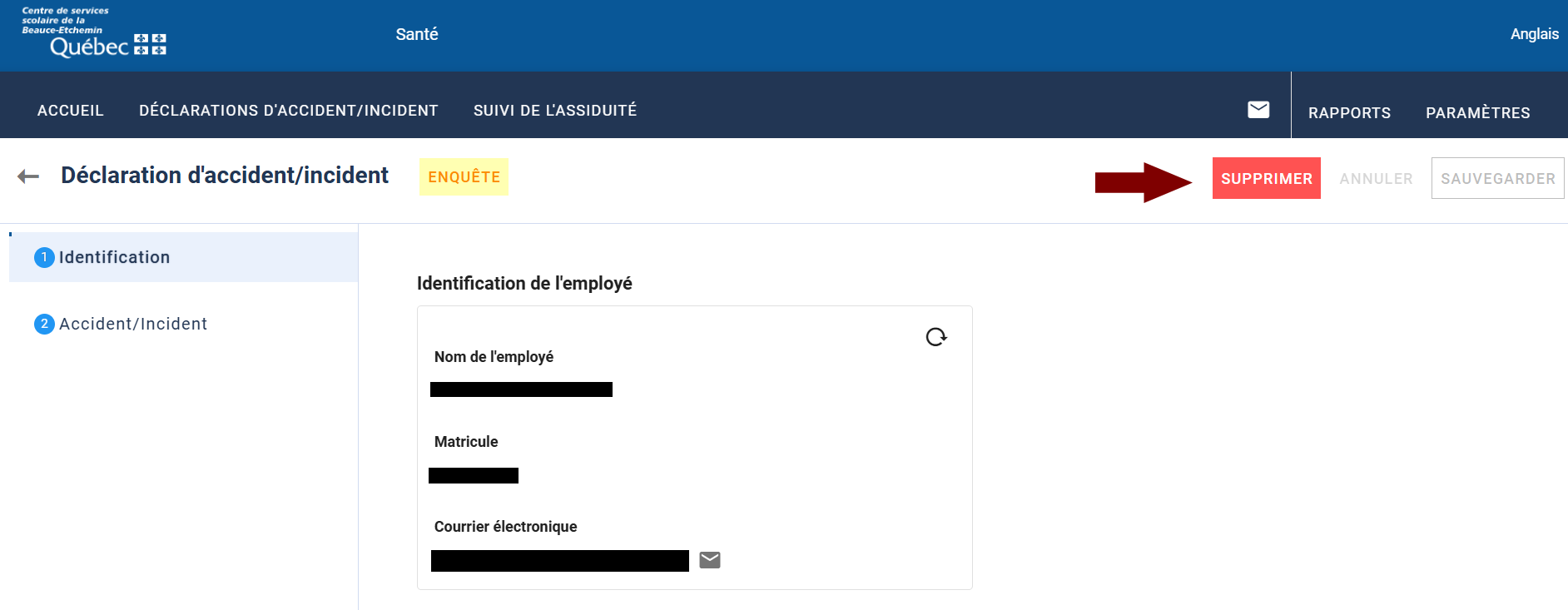 Supprimer une déclaration